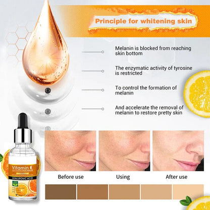 Disaar Vitamin C Hyaluronic Acid Serum – Anti-Aging & Skin Brightening (30ml)